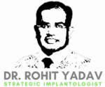 Dental Implants In India are trending in dentistry, and teeth replacement cost in India is more Reasonable than in other countries, shares Dr Rohit Yadav